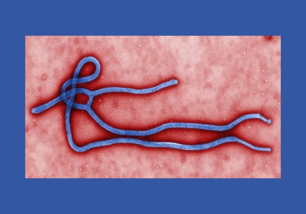 Ebola及MERS