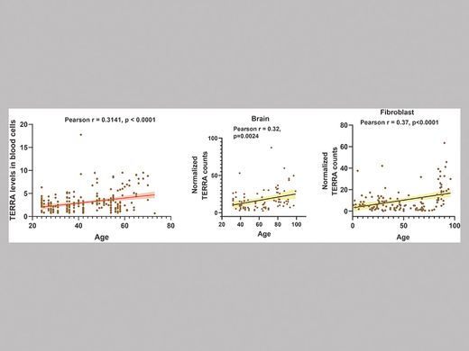 臺大研究團隊解開人類老化關鍵因子—端粒RNA (TERRA)之謎圖